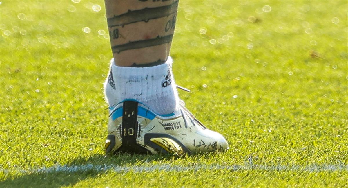 El tobillo derecho de Messi. Foto: EFE